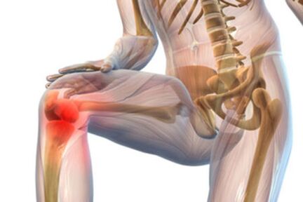 Πόνος στην άρθρωση του γόνατος με οστεοαρθρίτιδα