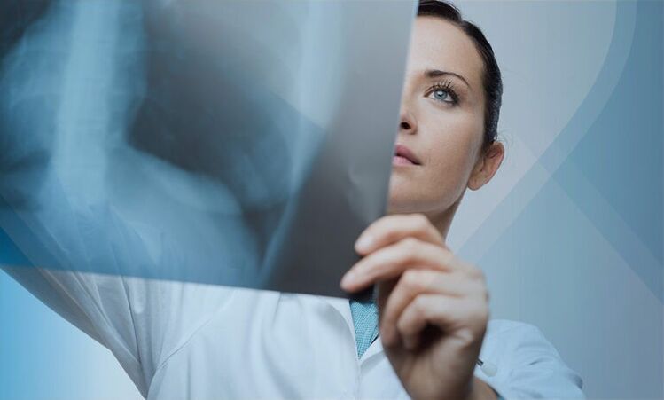Ένας γιατρός εξετάζει ένα στιγμιότυπο της αυχενικής μοίρας της σπονδυλικής στήλης με οστεοχονδρωσία